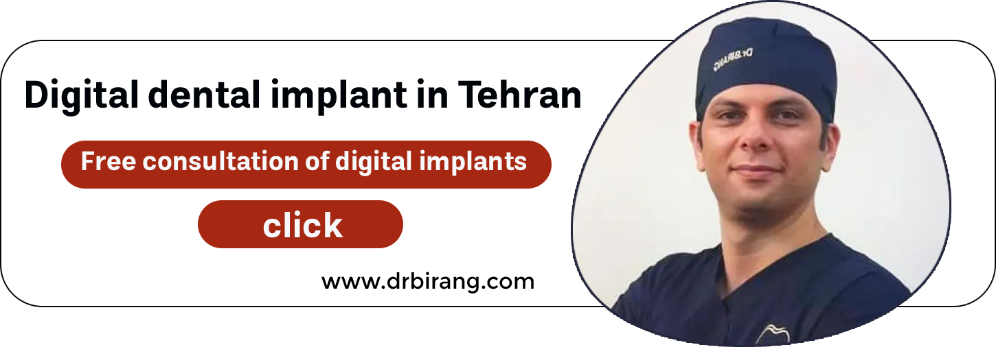 Digital dental implant in Tehran