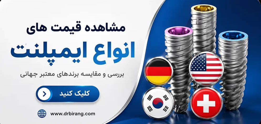 قیمت انواع ایمپلنت دندان در تهران| دکتر احسان بیرنگ، بهترین متخصص ایمپلنت در شمال تهران