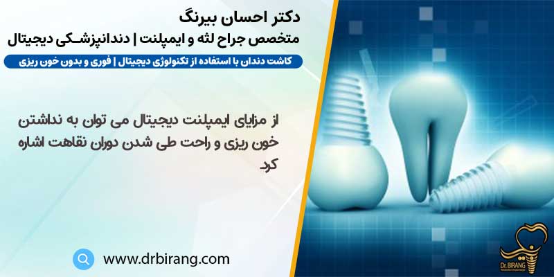 مزایای ایمپلنت دیجیتال در تهران توسط دکتر بیرنگ متخصص کاشت دندان به روش دیجیتال