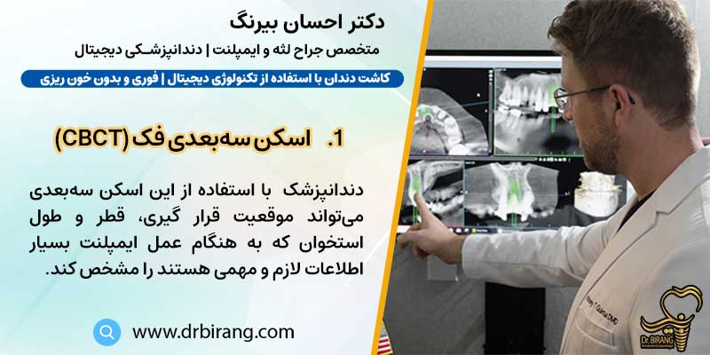 اسکن سه‌بعدی فک (CBCT) | دکتر احسان بیرنگ متخصص ایمپلنت دیجیتال در تهران