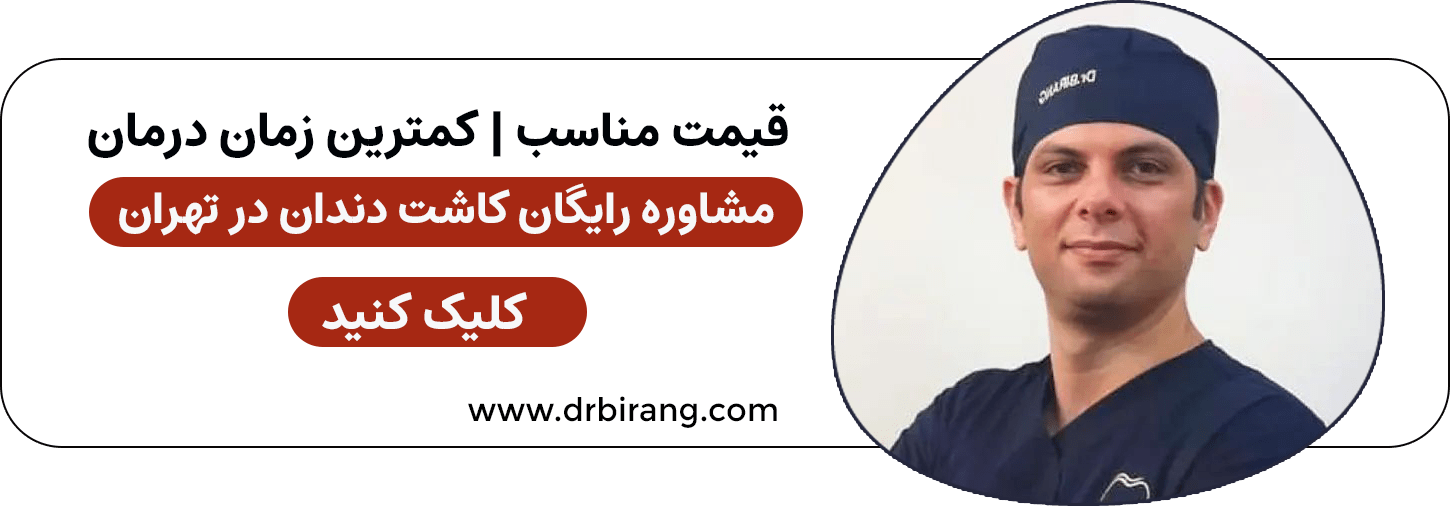 مشاوره رایگان کاشت دندان به روش دیجیتال در تهران توسط دکتر بیرنگ