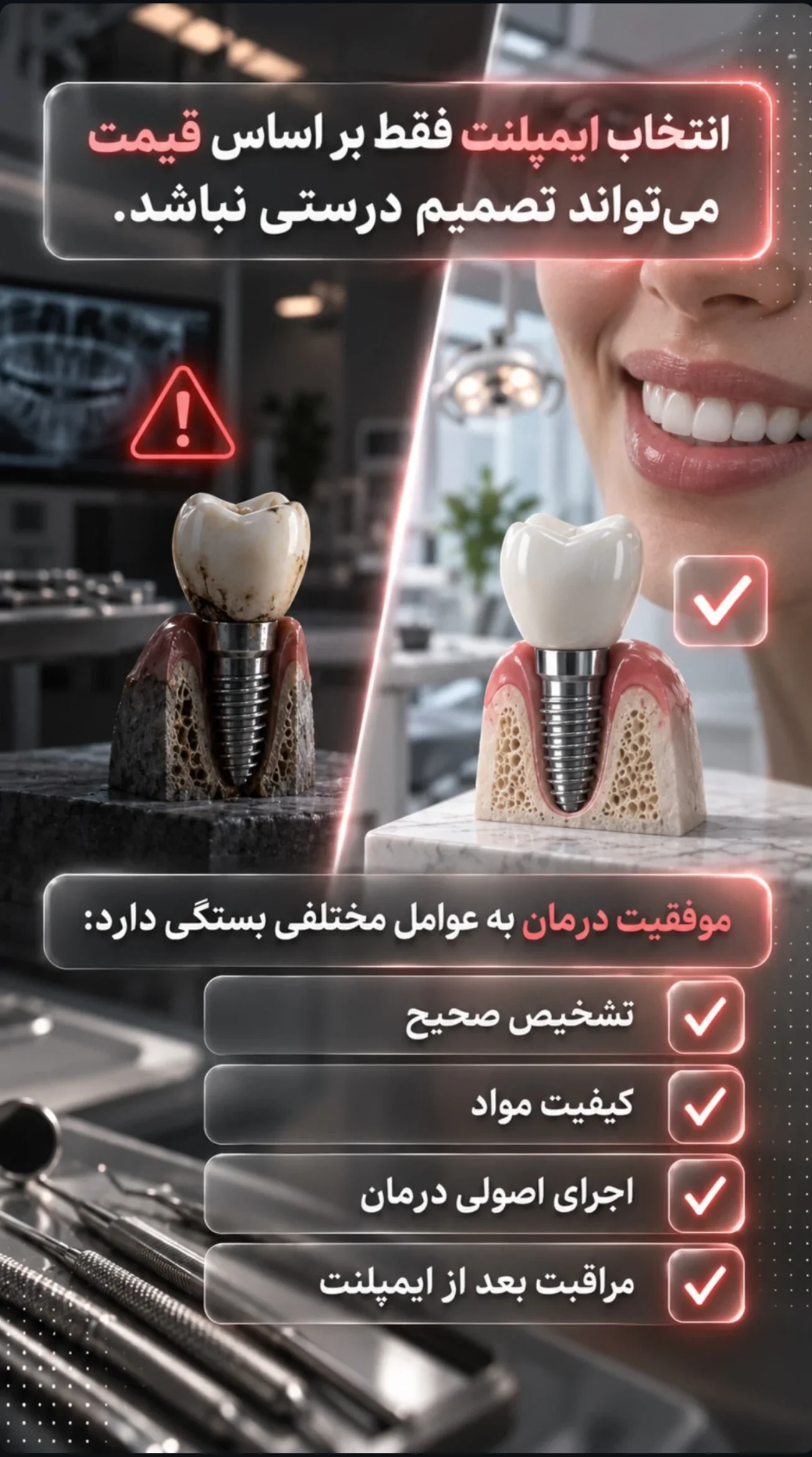 ایمپلنت ارزان در تهران