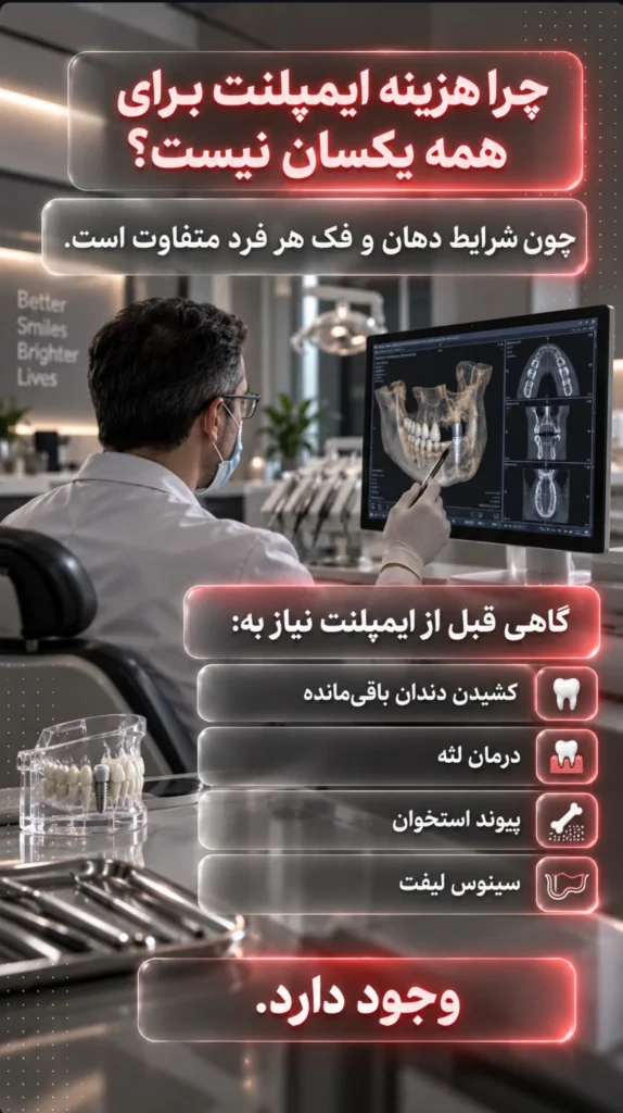 هزینه ایمپلنت دندان در تهران