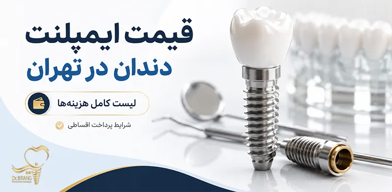 قیمت ایمپلنت در تهران دکتر احسان بیرنگ