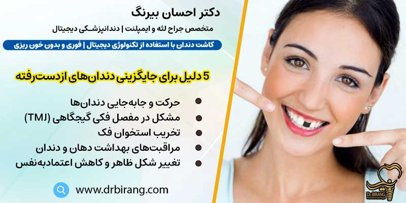 5 دلیل برای جایگزینی دندان‌های ازدست‌رفته | دکتر احسان بیرنگ متخصص ایمپلنت در تهران