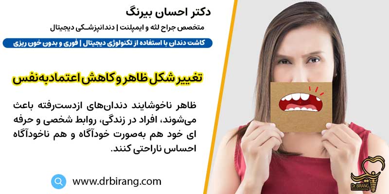 تغییر شکل ظاهر و کاهش اعتمادبه‌نفس در افراد | دکتر احسان بیرنگ متخصص ایمپلنت در تهران