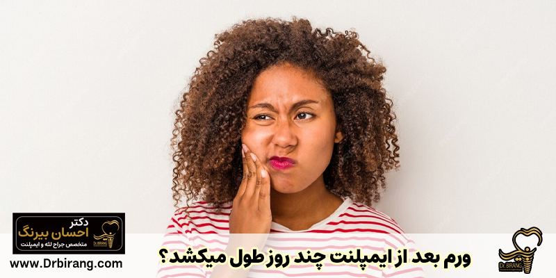 ورم بعد از ایمپلنت چند روز طول می کشد؟ | دکتر احسان بیرنگ متخصص ایمپلنت دندان در تهران