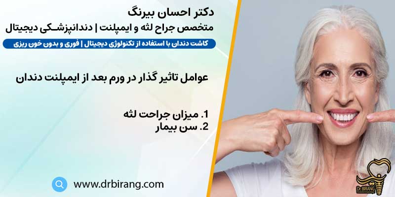 عوامل تاثیر گذار در ورم بعد از ایمپلنت دندان | دکتر بیرنگ متخصص ایمپلنت تهران