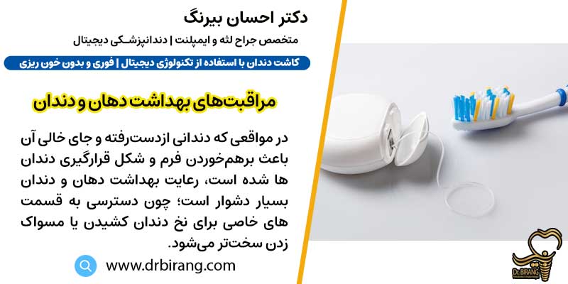 مشکل در مراقبت‌های بهداشت دهان و دندان | دکتر احسان بیرنگ متخصص ایمپلنت در تهران