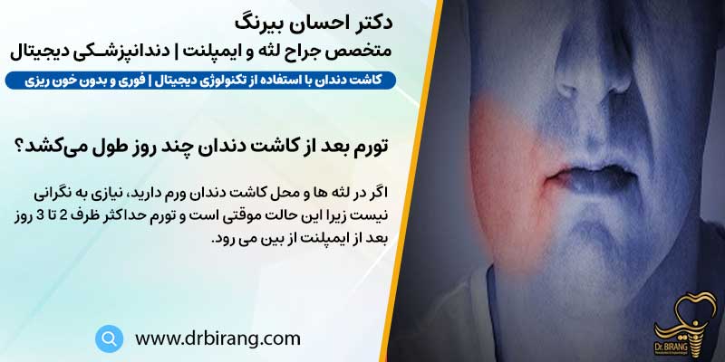 تورم بعد از کاشت دندان چند روز طول می کشد | دکتر احسان بیرنگ متخصص ایمپلنت تهران