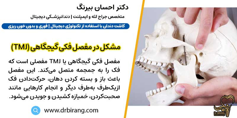 مشکل در مفصل فکی گیجگاهی (TMJ) | دکتر احسان بیرنگ متخصص ایمپلنت در تهران