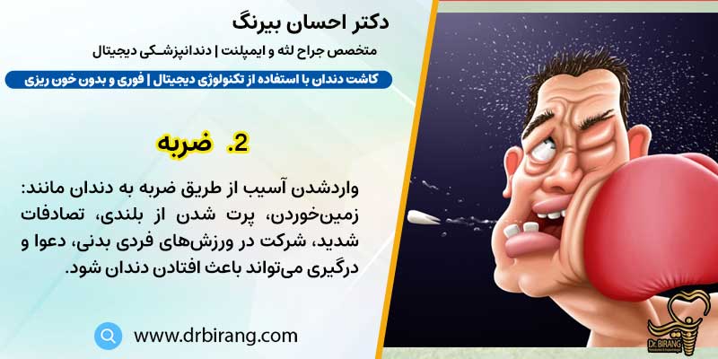 ضربه به دندان علت ازبین‌رفتن دندان‌ها | دکتر احسان بیرنگ متخصص ایمپلنت در تهران