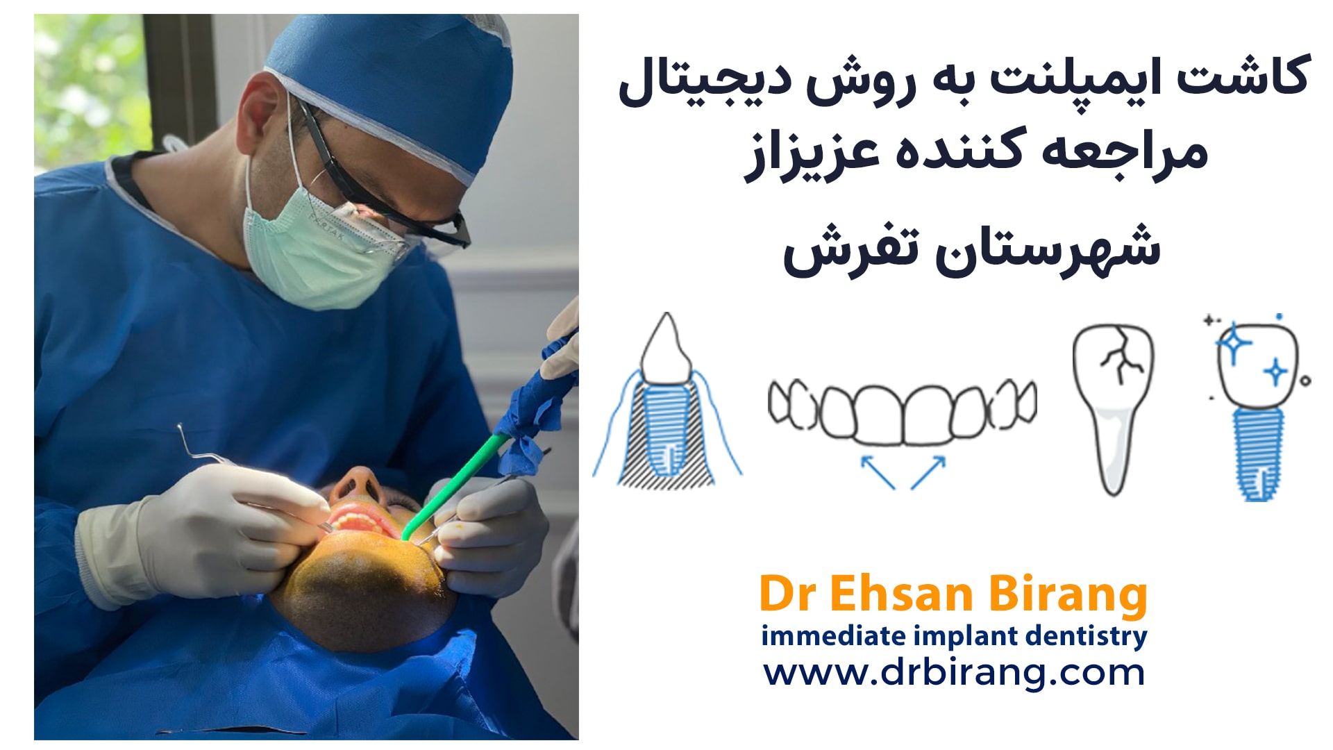 درمان خارج‌سازی دندان، ایمپلنت‌گذاری و پیوند استخوان و پیوند لثه در یک جلسه بیمار از تفرش | دکتر احسان بیرنگ فوق تخصص ایمپلنت دیجیتال در شمال تهران