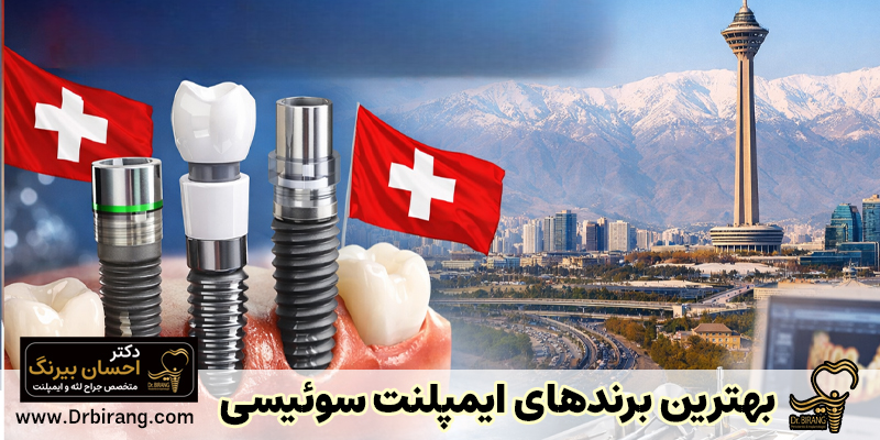 بهترین برندهای ایمپلنت سوئیسی در مرکز ایمپلنت دکتر بیرنگ در تهران