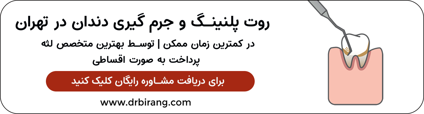 انجام جرم گیری دندان و روت پلنینگ در زعفرانیه تهران | دکتر احسان بیرنگ