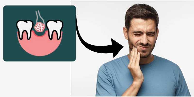 عوارض جانبی پیوند استخوان دندان چیست؟