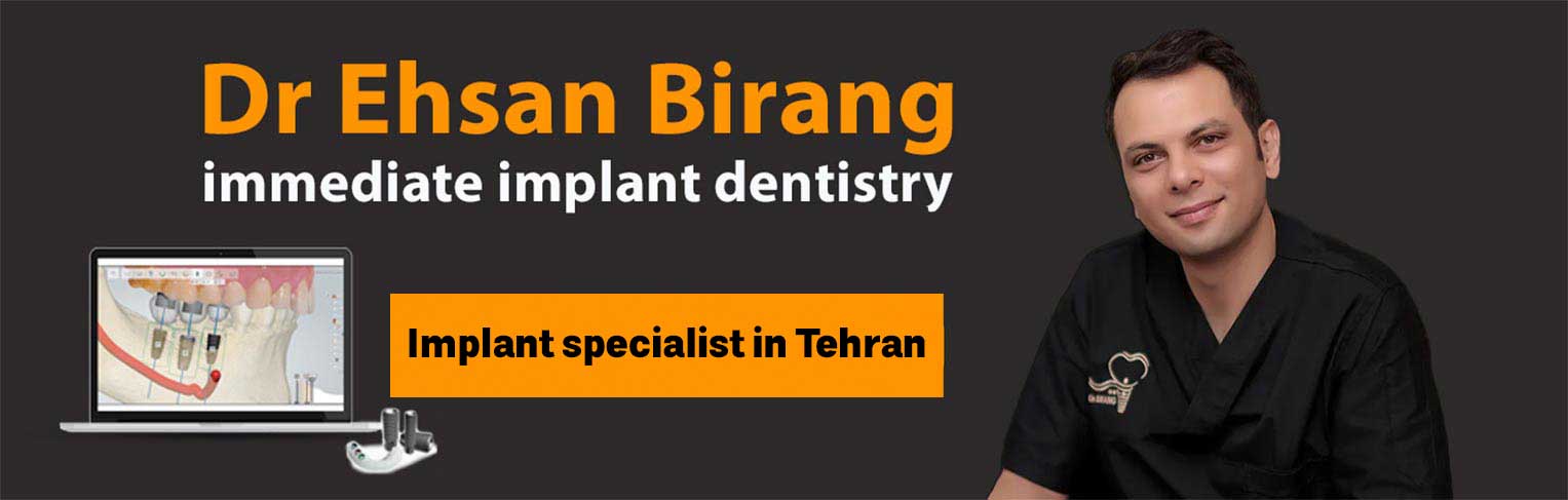 Dr. Ehsan Birang, an implant specialist in Tehran