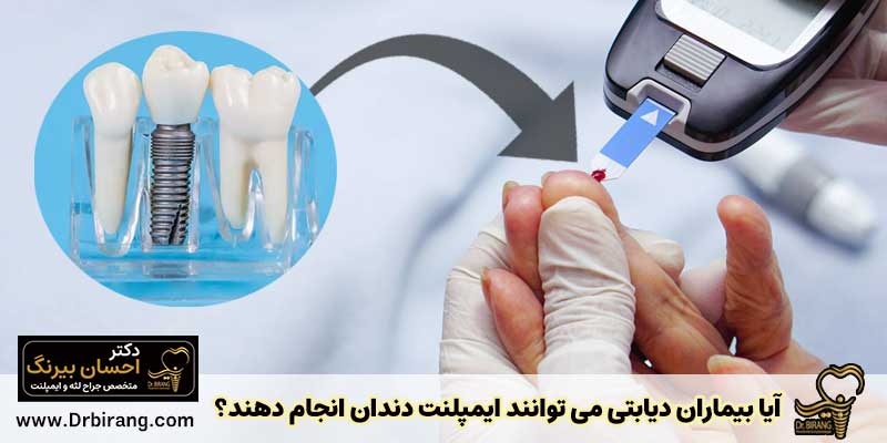 آیا بیماران دیابتی می توانند ایمپلنت دندان انجام دهند؟