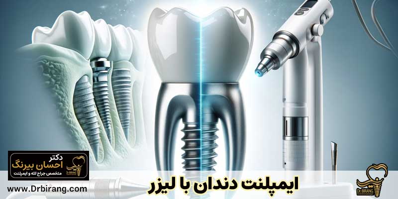ایمپلنت دندان با لیزر