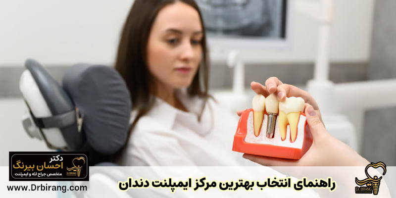 راهنمای انتخاب بهترین کلینیک و متخصص ایمپلنت دندان
