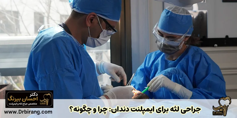 جراحی لثه برای ایمپلنت دندان: چرا و چگونه؟