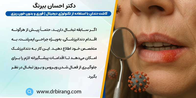 herpes and dentistry