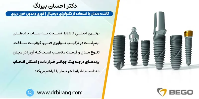 ویژگی های ایمپلنت بگو آلمان 