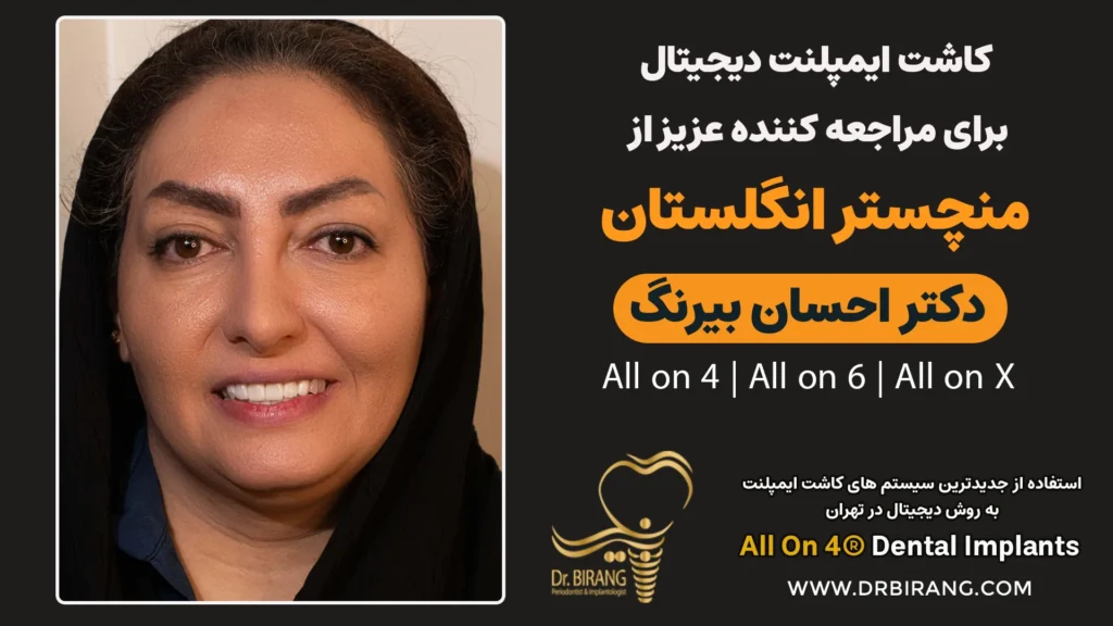 کاشت ایمپلنت دیجیتال برای مراجعه کننده عزیز ازمنچستر انگلستان