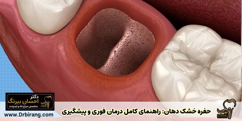 پیشگیری و درمان حفره خشک دهان