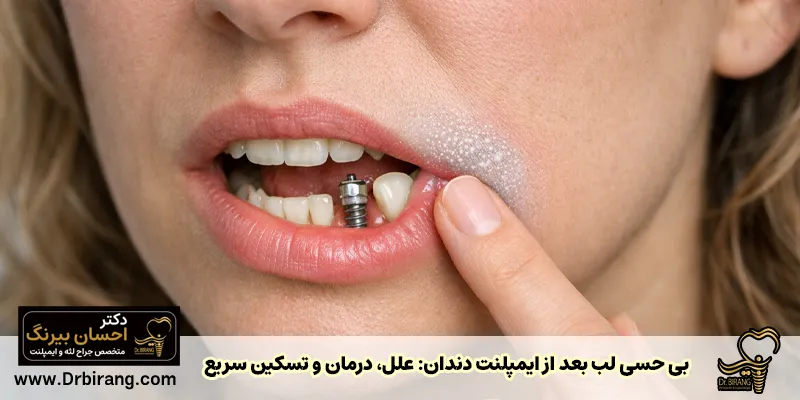 بی حسی لب بعد از ایمپلنت