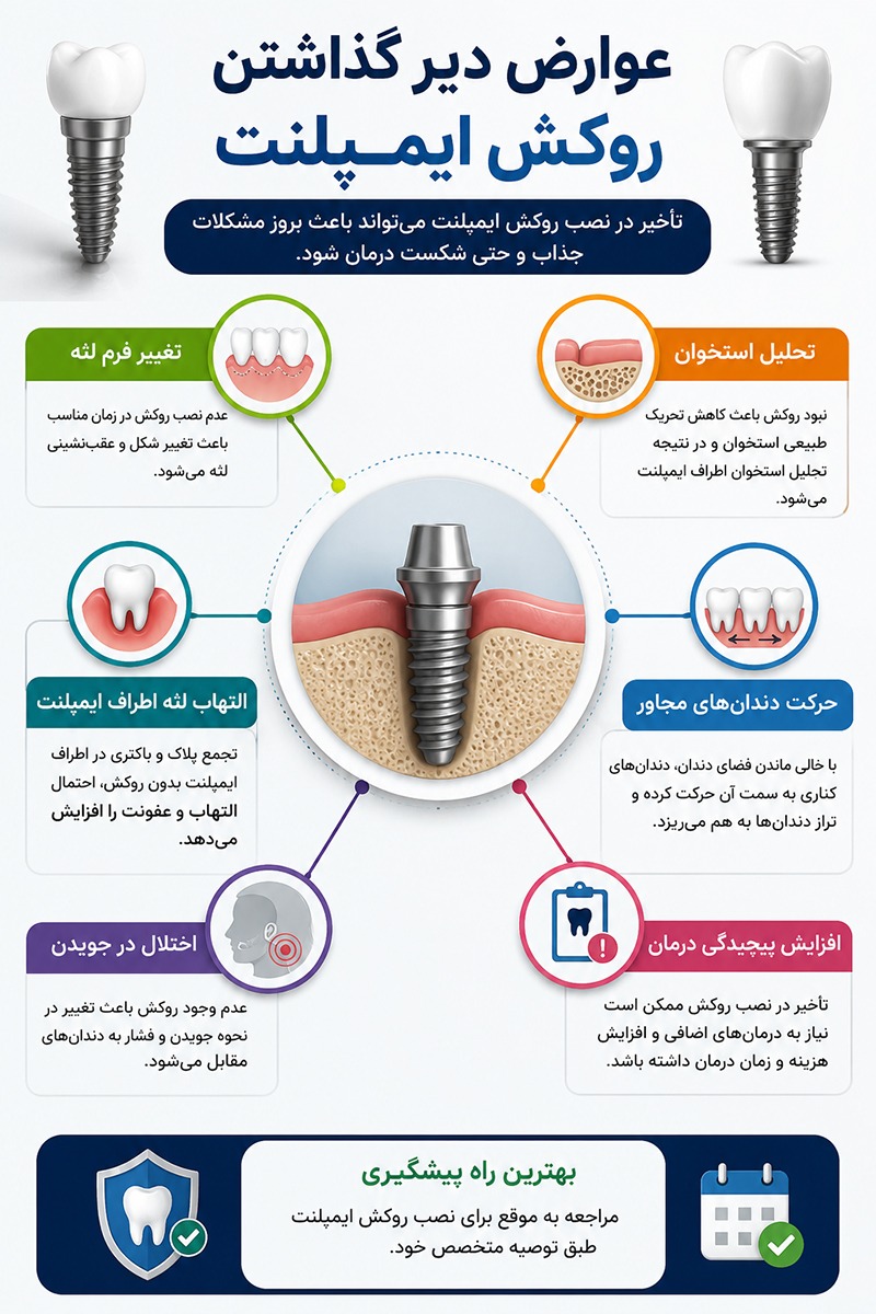 عوارض دیر گذاشتن روکش ایمپلنت دندان